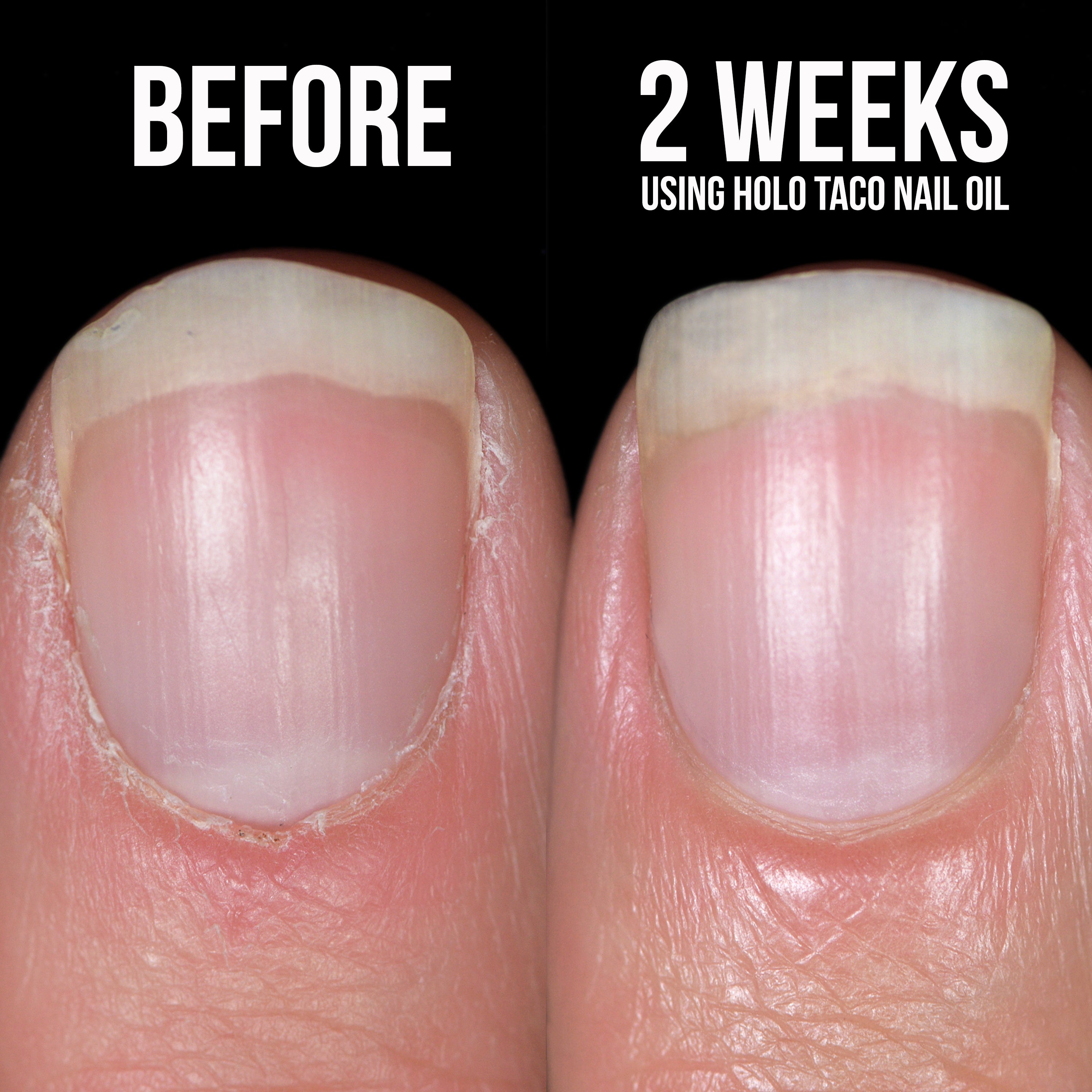 Nail Oil Replacement Cartridges (2 pk) preview